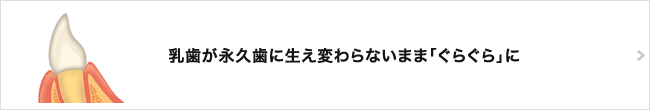 乳歯が永久歯に生え変わらないまま「ぐらぐら」に