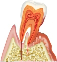 歯周病